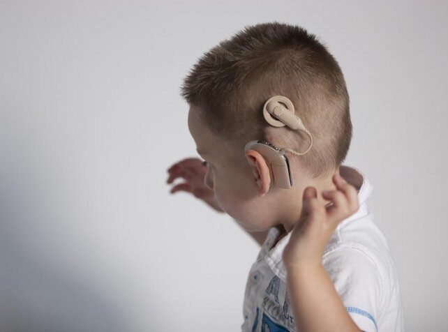 Cochlear implant